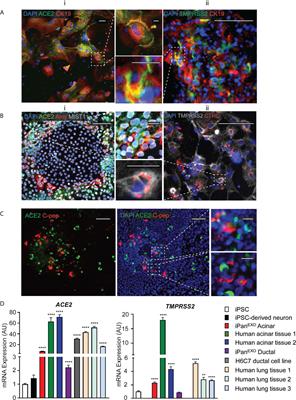 Deleterious Effects of SARS-CoV-2 Infection on Human Pancreatic Cells